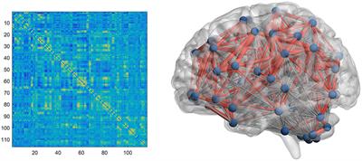 Abnormal Brain Network Topology During Non–rapid Eye Movement Sleep and Its Correlation With Cognitive Behavioral Abnormalities in Narcolepsy Type 1
